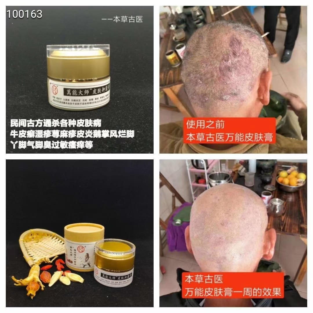 万能皮肤膏